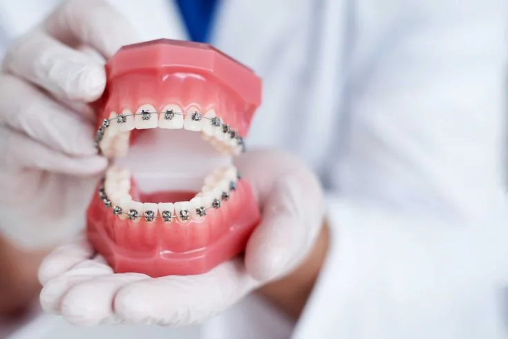 Orthodontics & Dentofacial Orthopedics